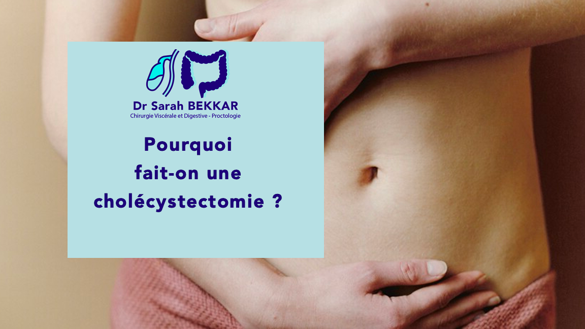 Pourquoi fait-on une cholécystectomie ? - Dr Sarah BEKKAR